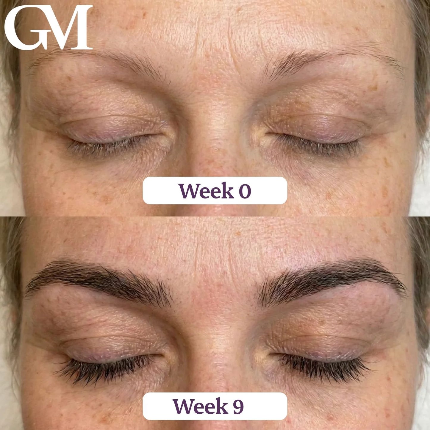 GraceLash Eyelash Enhancing Serum