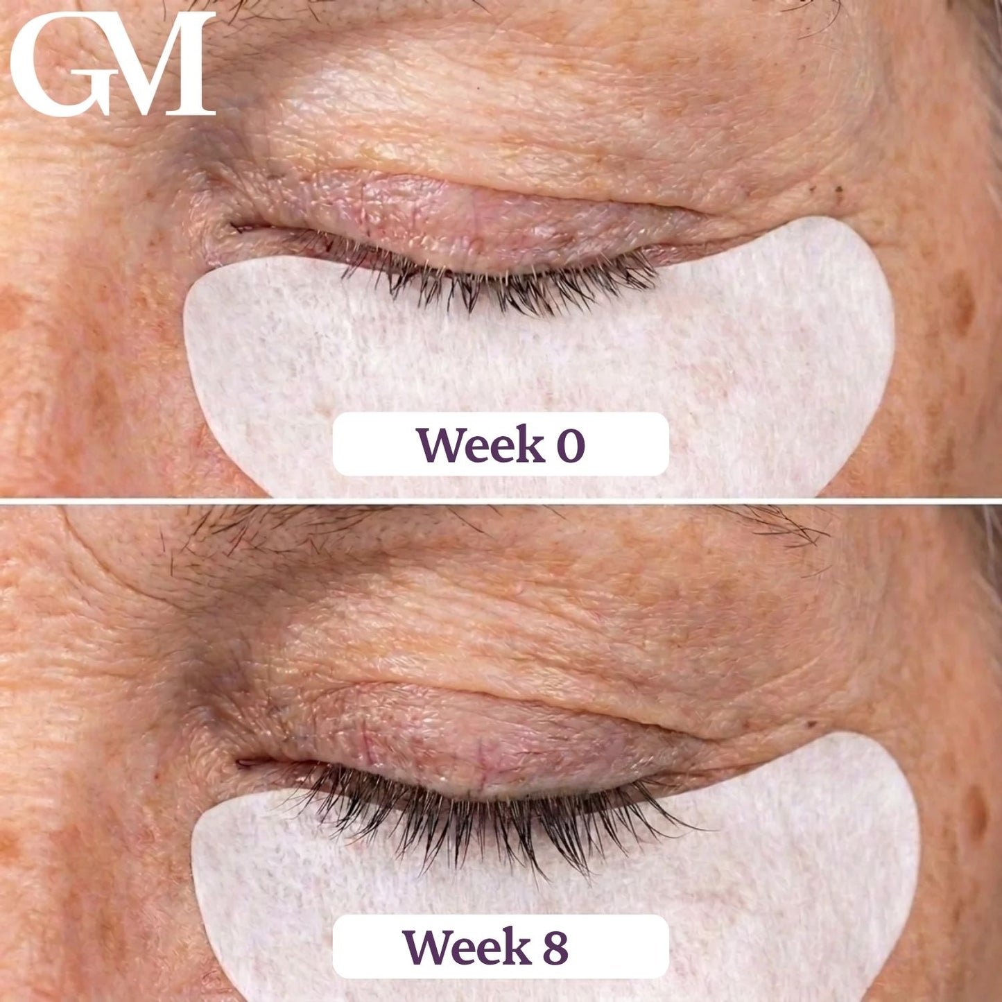 GraceLash Eyelash Enhancing Serum