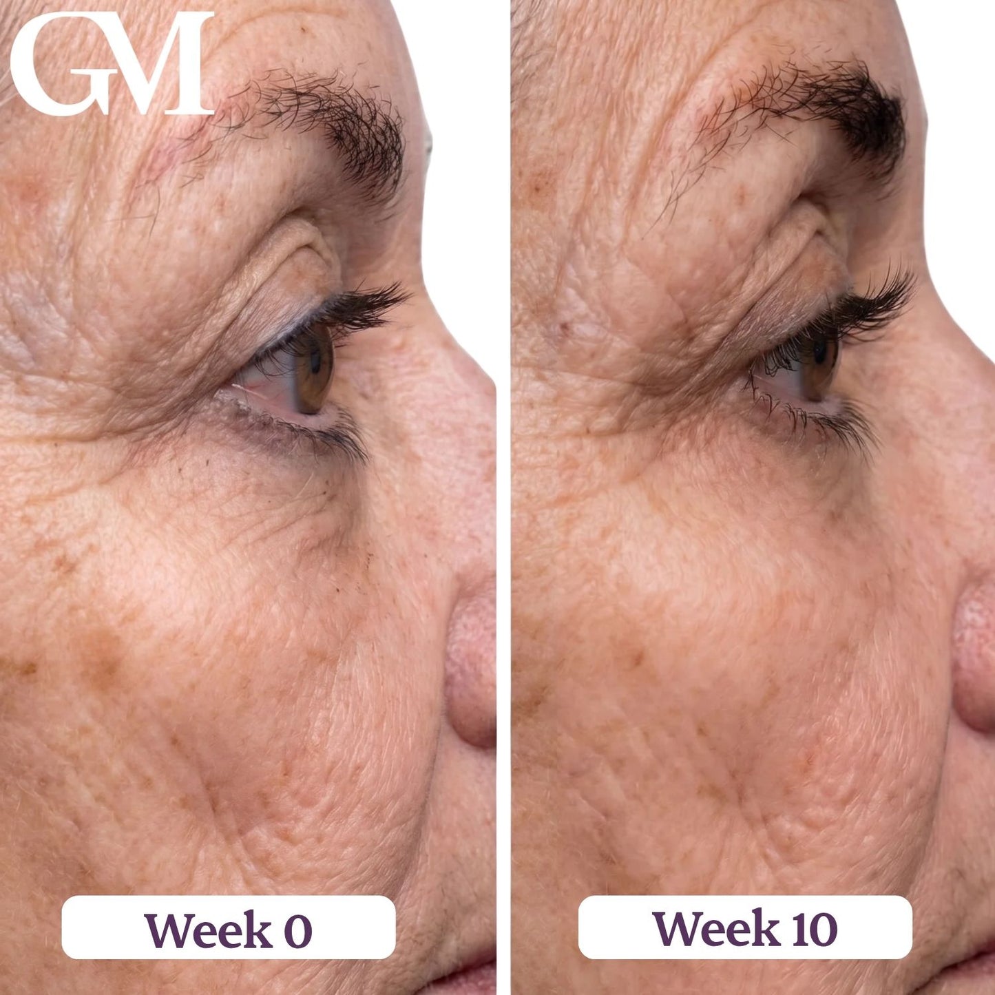 GraceLash Eyelash Enhancing Serum
