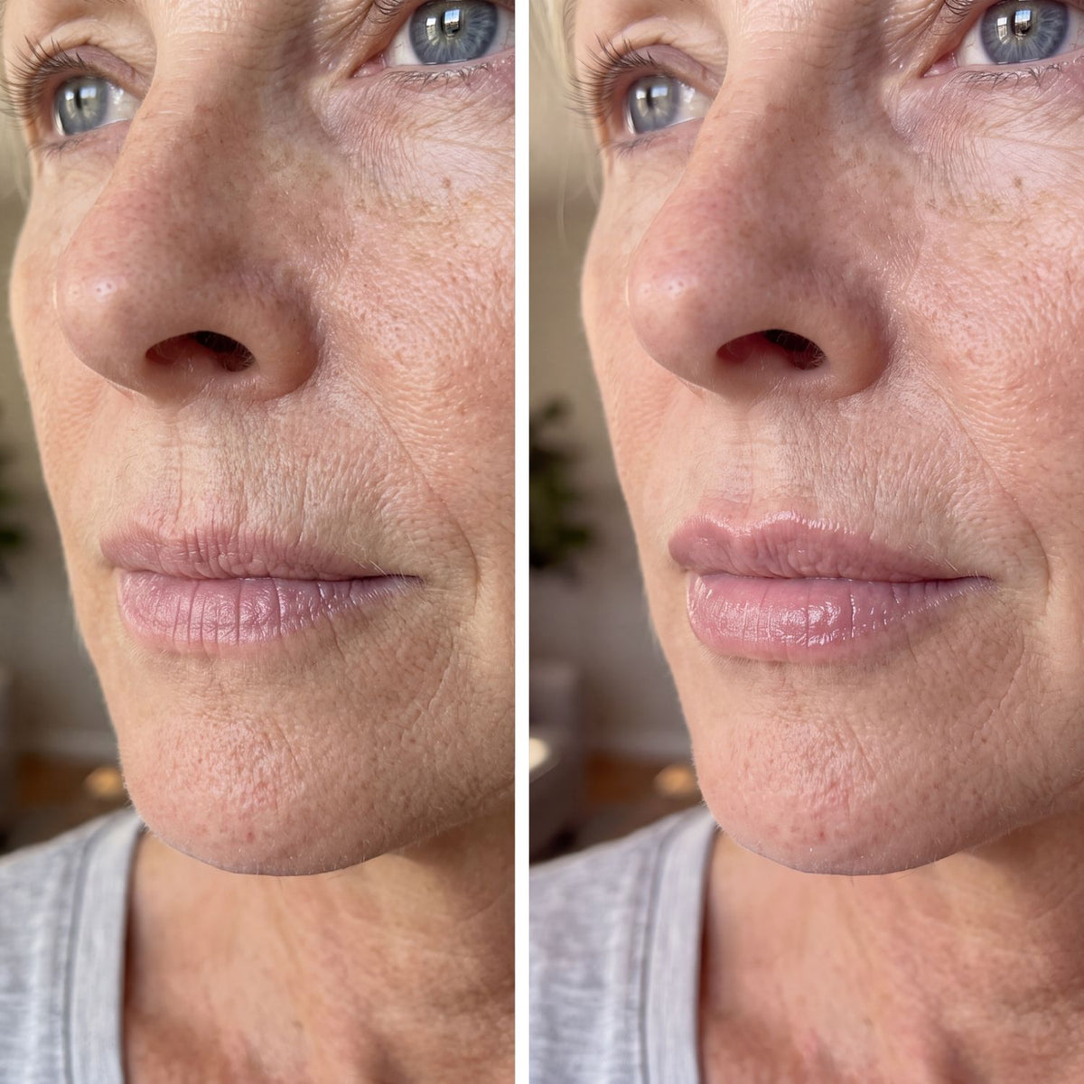 GraceLips - Original Lip Plumper